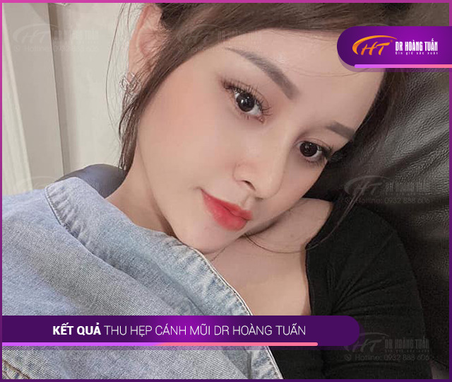 Kết quả phẫu thuật